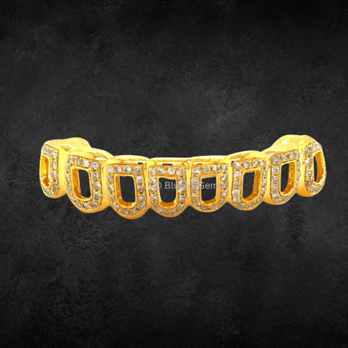 The "Golden Window" Diamond Grillz