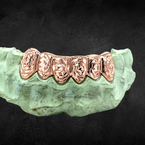 The "Rose Gold Etched" Grillz