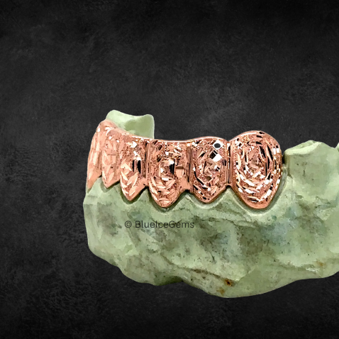 The "Rose Gold Etched" Grillz