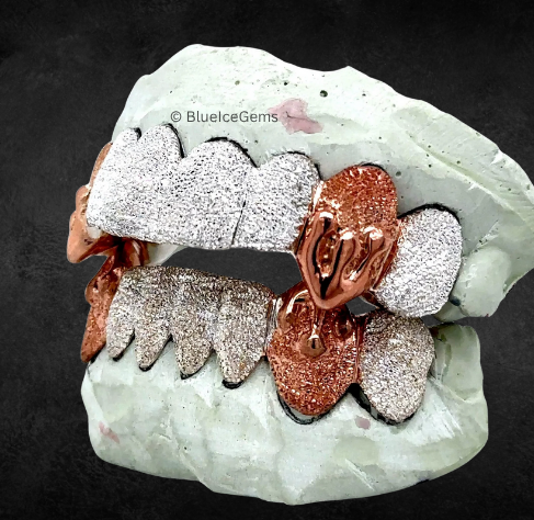 The "Rose Gold Fang" Dual-Tone Diamond Grillz