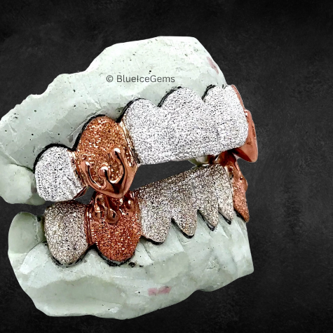 The "Rose Gold Fang" Dual-Tone Diamond Grillz