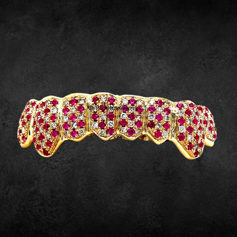 The "Ruby Reign" Diamond & Ruby Grillz