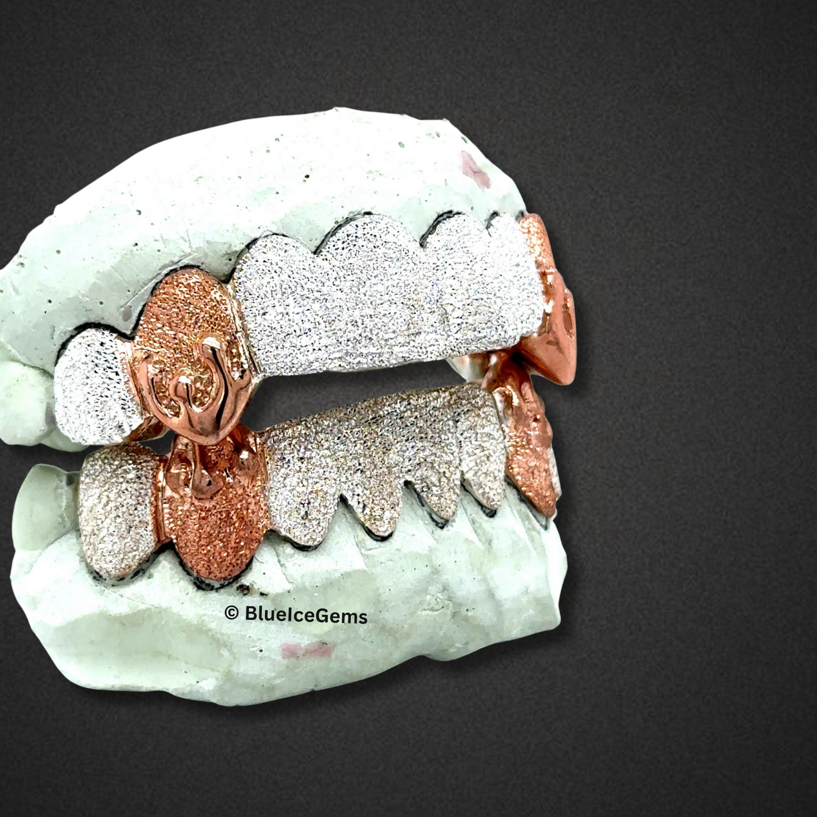 Blaze Frost Two‑Tone Grillz