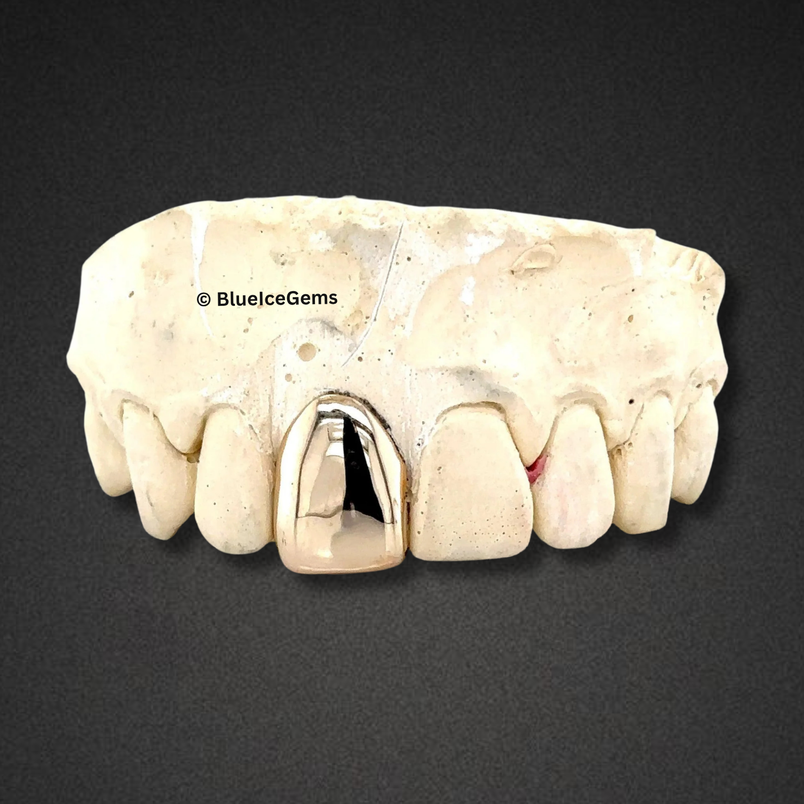 MonoBeam Solid Cap Grillz