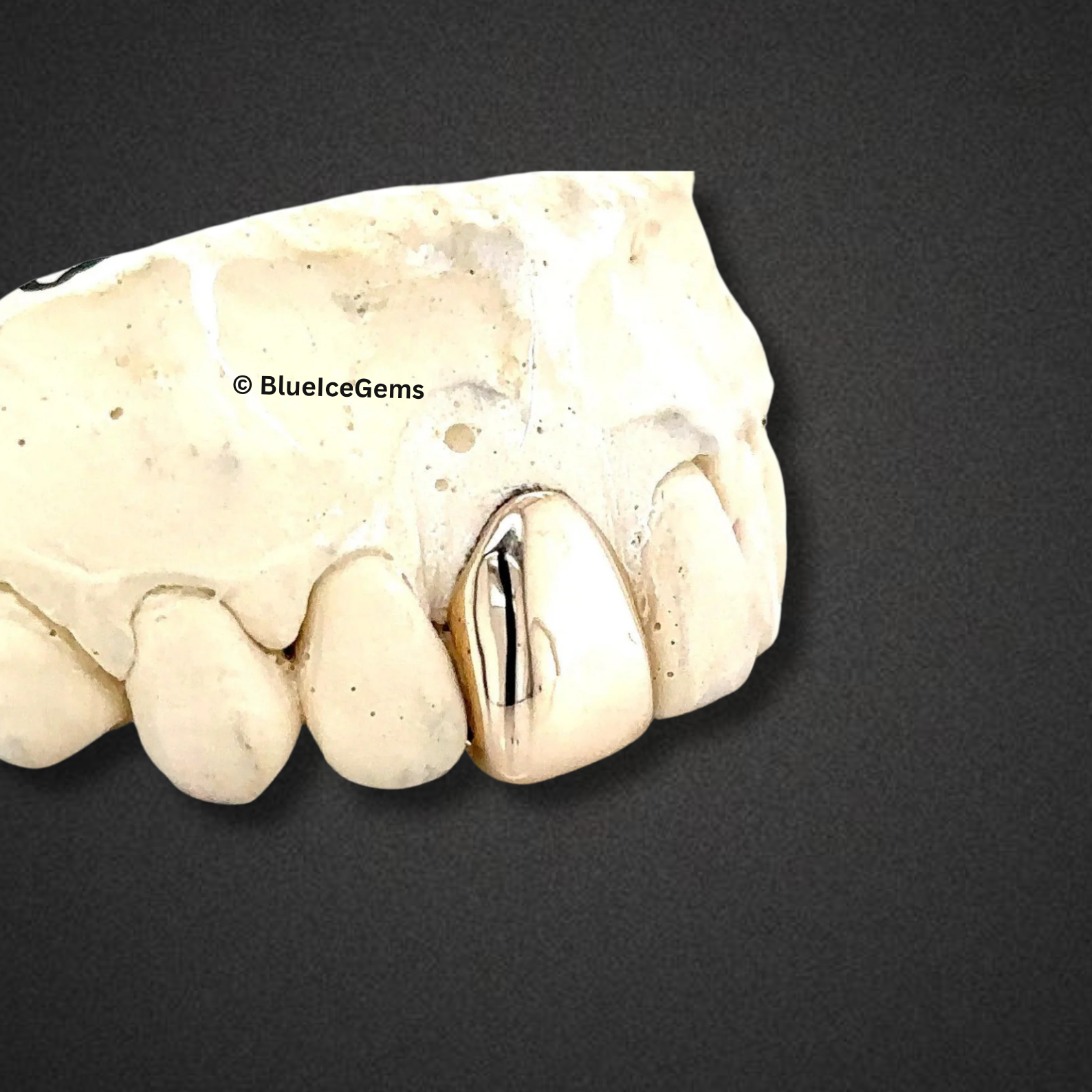 MonoBeam Solid Cap Grillz