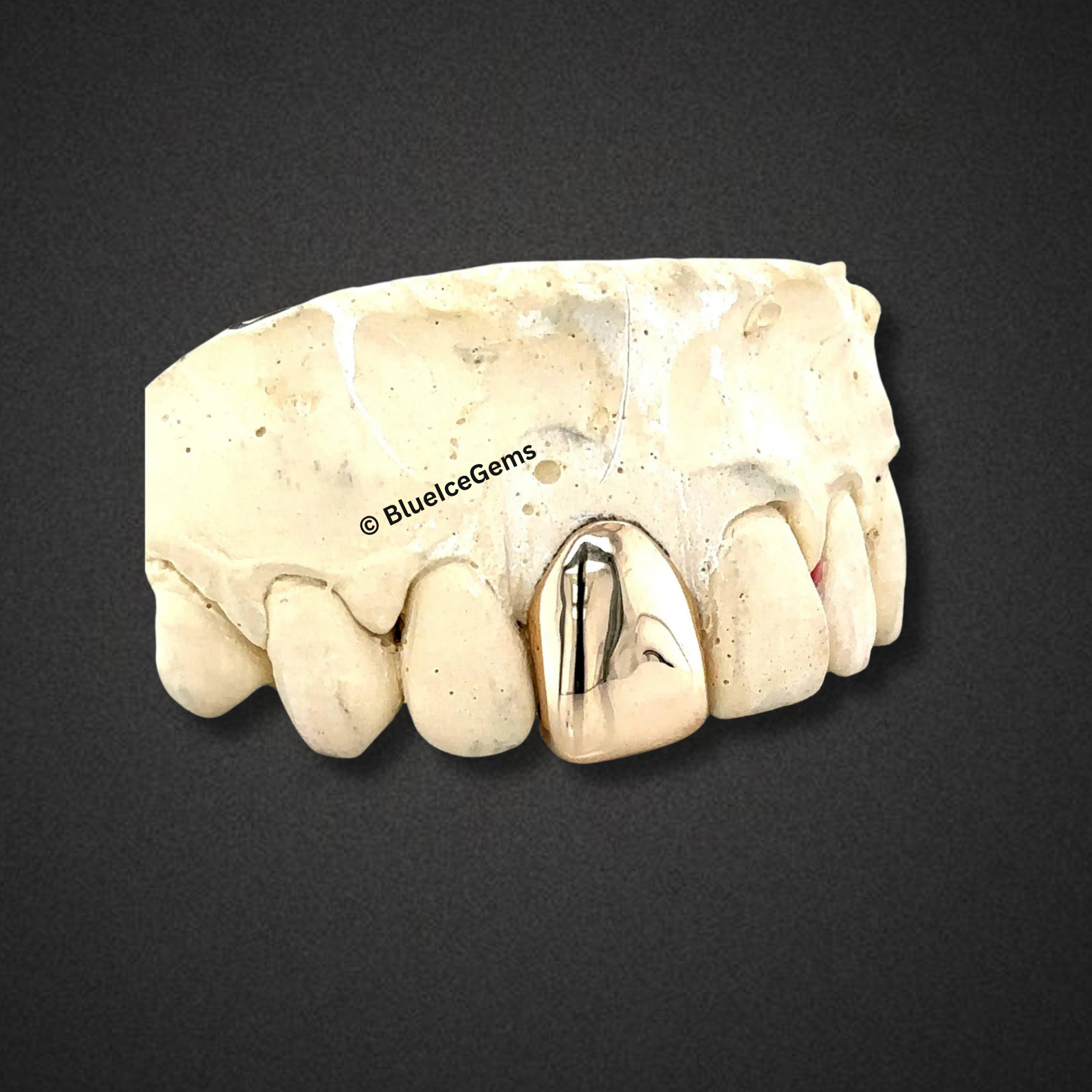 MonoBeam Solid Cap Grillz