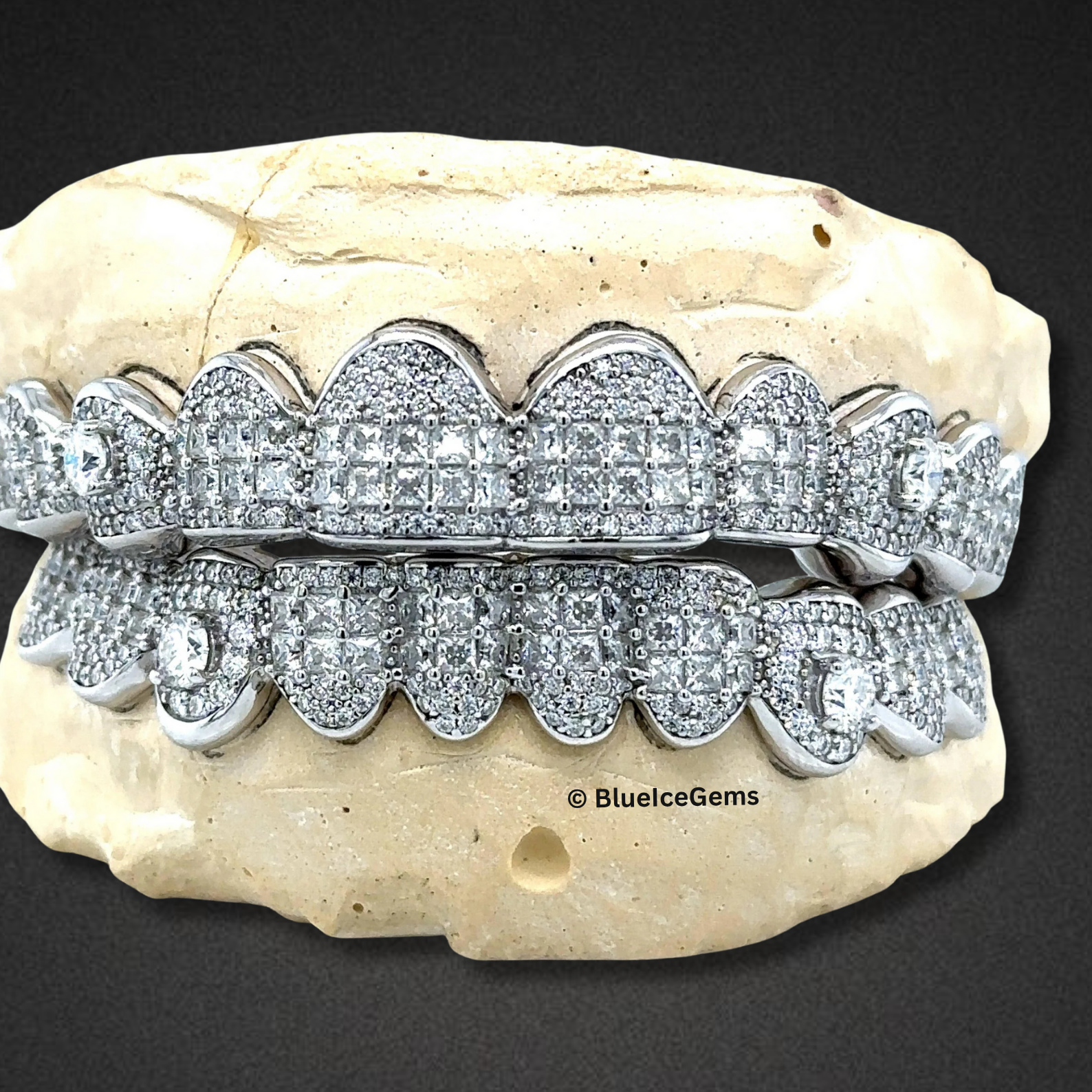 Frostbyte Diamond Grillz