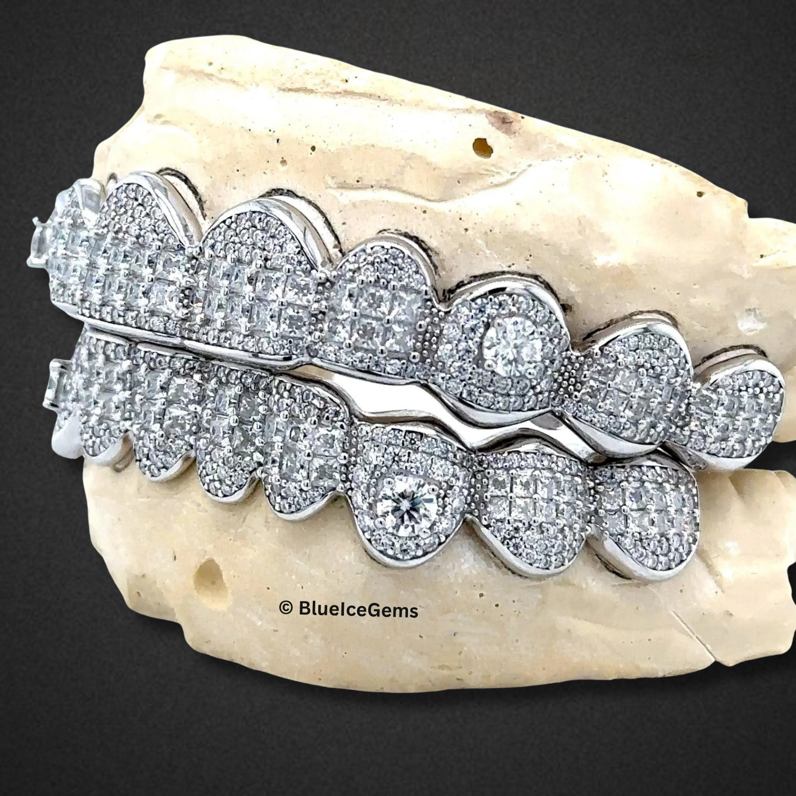 Frostbyte Diamond Grillz