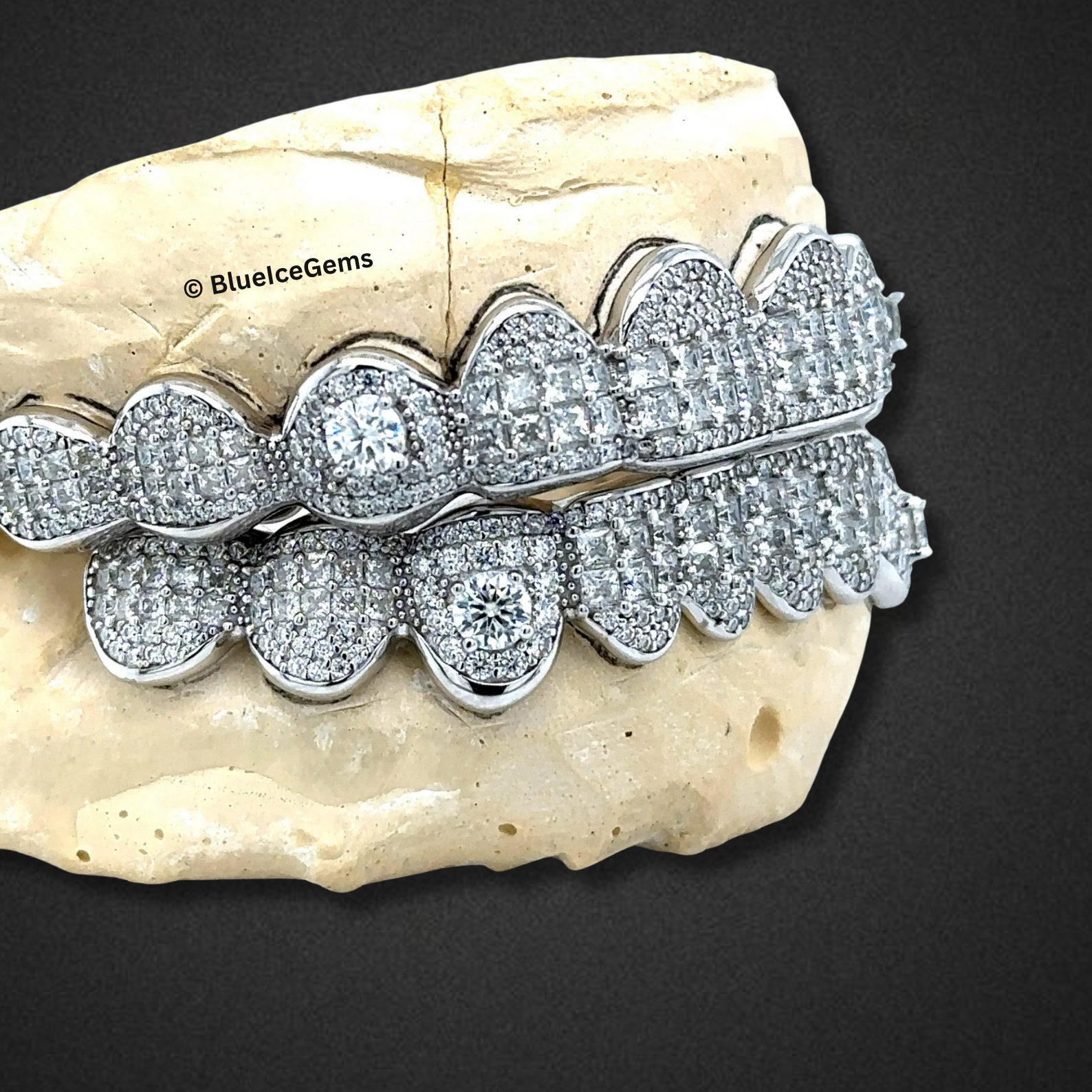 Frostbyte Diamond Grillz