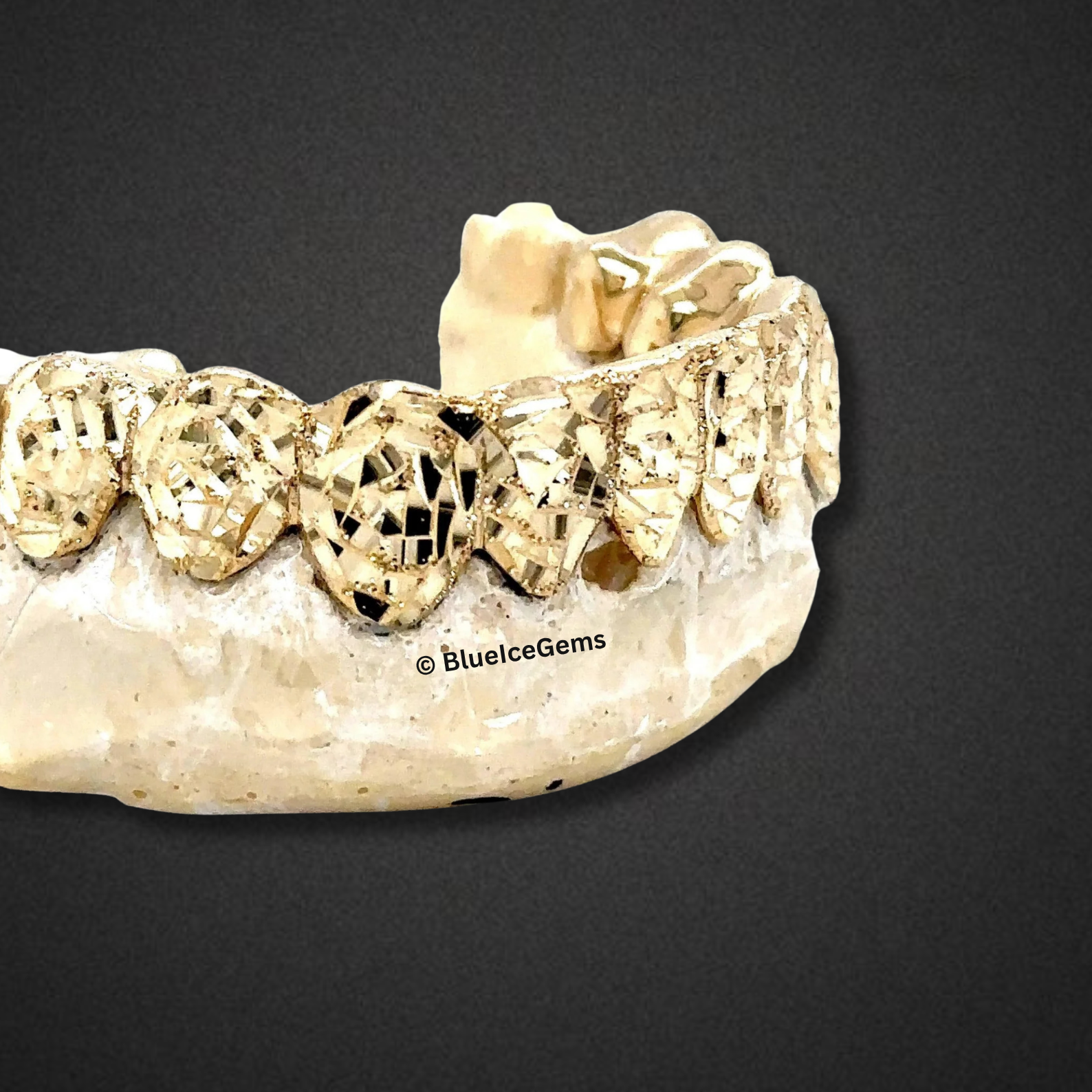 Golden Avalanche Diamond-Cut Grillz