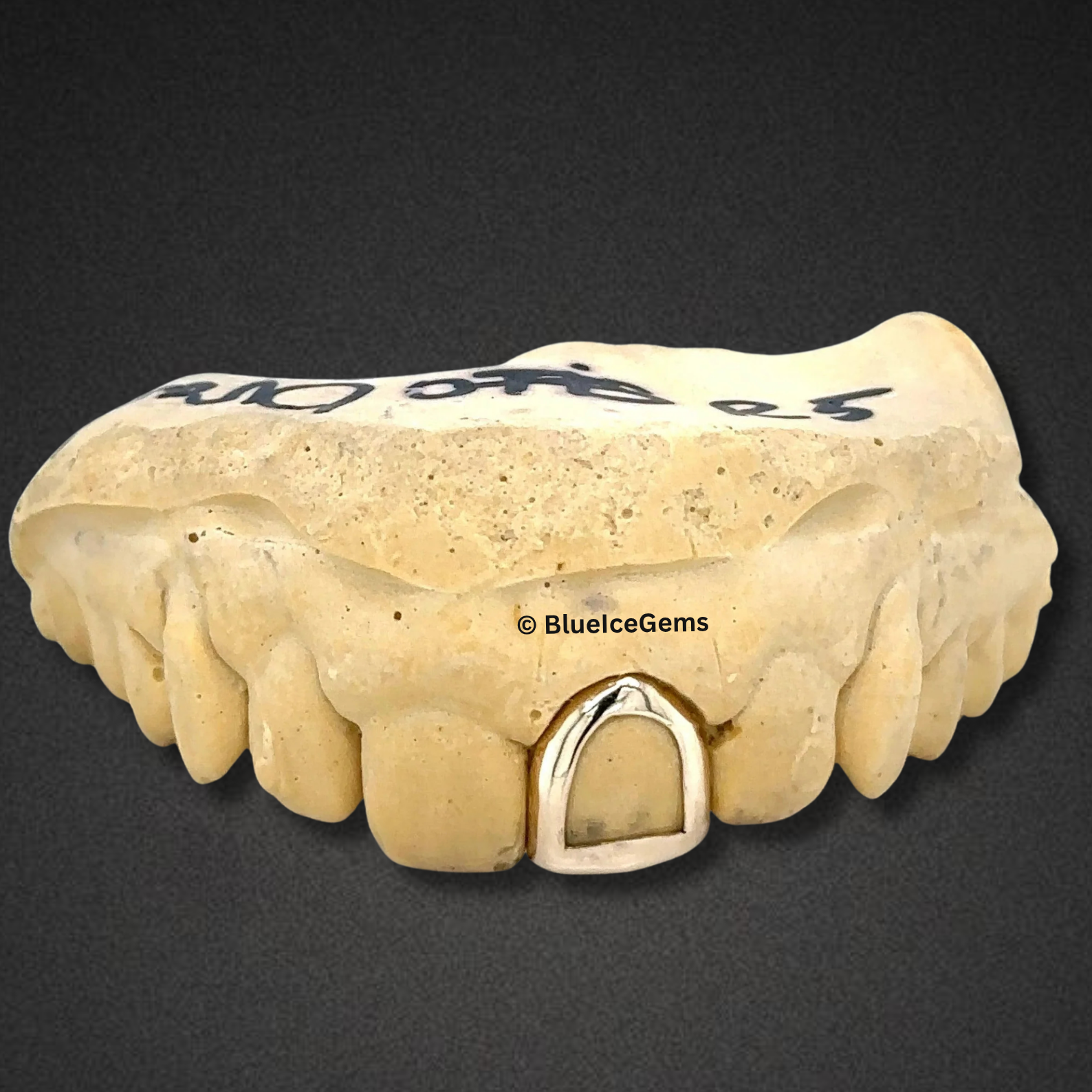 Gold Halo Single Tooth Cap Grillz