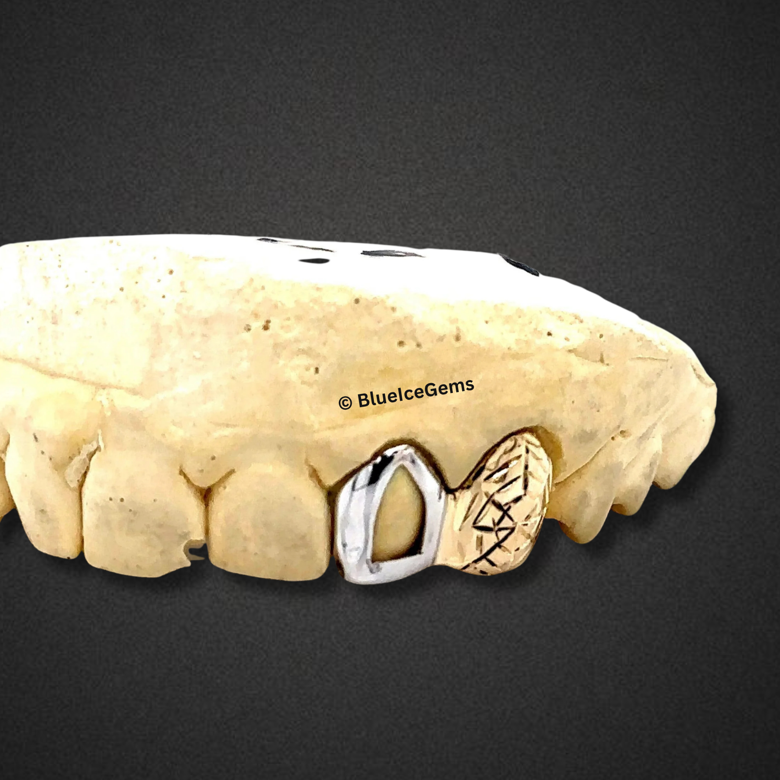 Two-Tone Geo Halo Tooth Cap Grillz