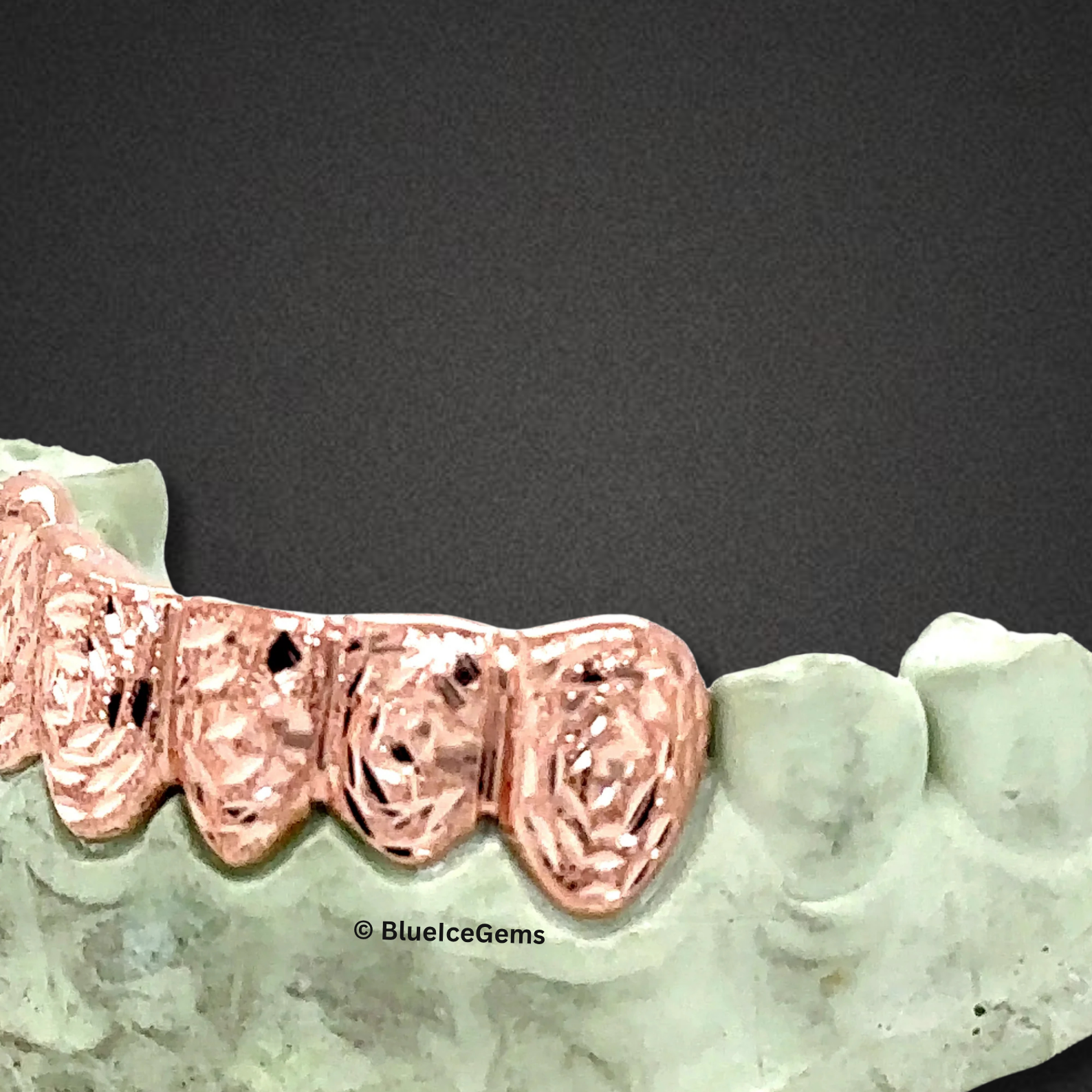 Rose Atlas Engraved Grillz